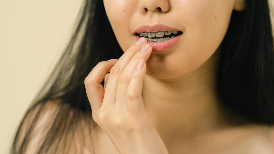 Suchość jamy ustnej – leczenie