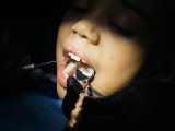 Ból zęba - domowe sposoby leczenia. Czy to działa